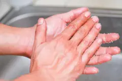 Como Tirar Durepox da Mão (8)